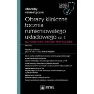 Obrazy kliniczne tocznia rumieniowatego układowego Część 2 Na podstawie opisów przypadków: W gabinecie lekarza specjalisty. Reumatologia - 07121a00218ks.jpg