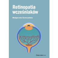 Retinopatia wcześniaków - 29446b02434ks.jpg