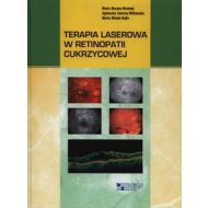 Terapia laserowa w retinopatii cukrzycowej - 637373i.jpg