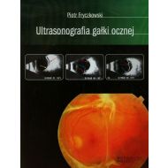 Ultrasonografia gałki ocznej - 641891i.jpg