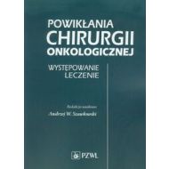 Powikłania chirurgii onkologicznej: Występowanie Leczenie - 673159i.jpg