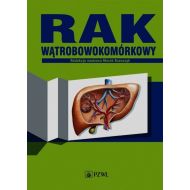 Rak wątrobowokomórkowy - 742067i.jpg