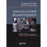 Diagnostyka obrazowa zapalnych chorób reumatycznych - 816399i.jpg