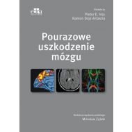 Pourazowe uszkodzenie mózgu - 860193i.jpg