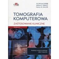 Tomografia komputerowa Zastosowanie kliniczne - 867566i.jpg