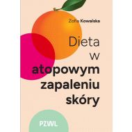 Dieta w atopowym zapaleniu skóry - 97419b00218ks.jpg